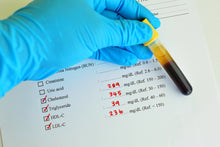 Laden Sie das Bild in den Galerie-Viewer, Funktionelle Blutanalyse (Exkl. Laborkosten)